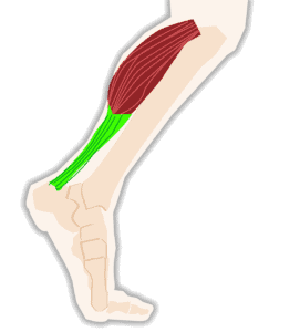 tendinitis or tendinosis