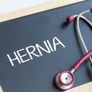 sports hernia physical therapy